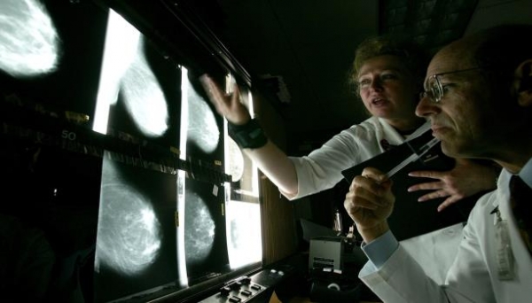 علاج بريطاني لأورام الثدي يجعلها تختفي في 11 يوما