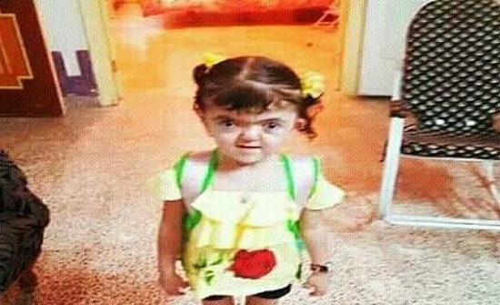 طرد طفلة سورية من الحضانة بسبب شكلها