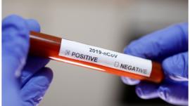 لغز الفيروس التاجي الذي نام (5) سنوات!.. تقرير مثير يلقي الزيت على نار نظرية المؤامرة