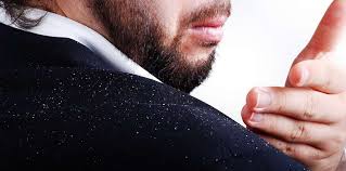 علاجات منزلية لإزالة قشرة الشعر بطريقة طبيعية وطرق تحضيرها