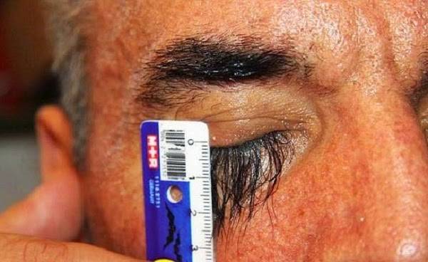 صور: صاحب أطول رموش في العالم