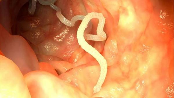 كيف تعرف أن الدودة الشريطية تعيش داخلك